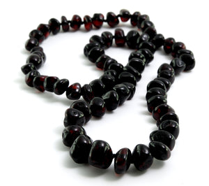 Adult Cherry Amber Necklace