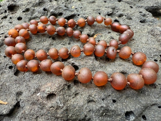 Raw Cognac Amber Necklace